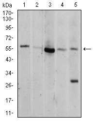 WB - Mouse Monoclonal Antibody to AKT1 AO2331a